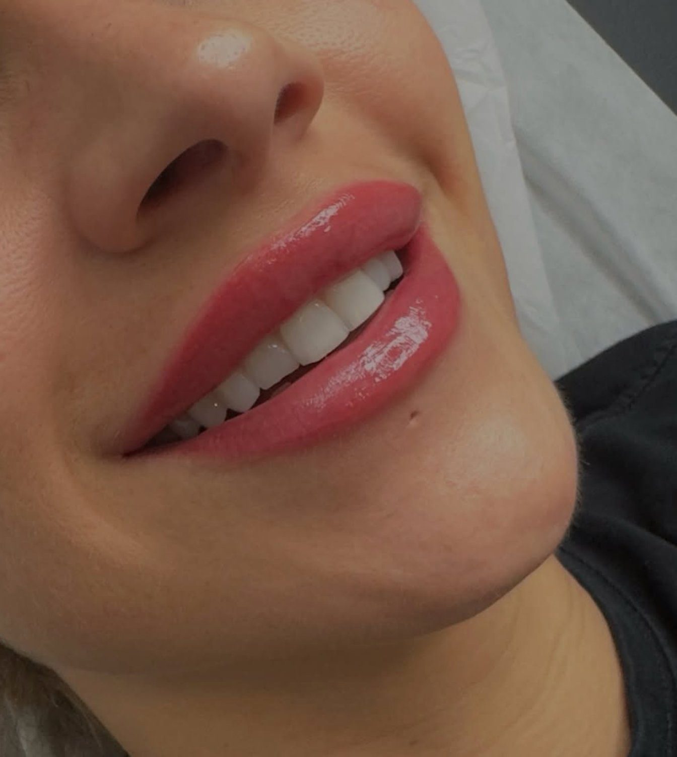 Lip blush result in Montreal's West Island — a client's smile with soft coral-rose semi-permanent lip color